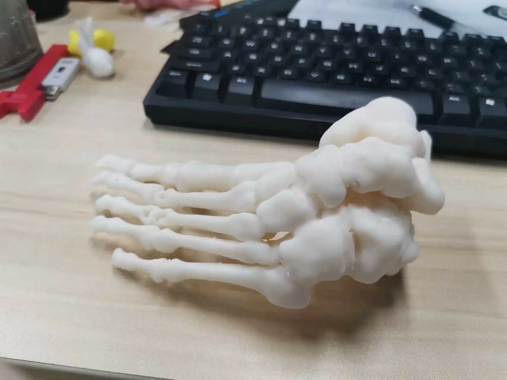 脚踝关节高清图（医疗矫正）