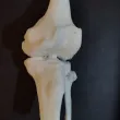 数字医疗模型